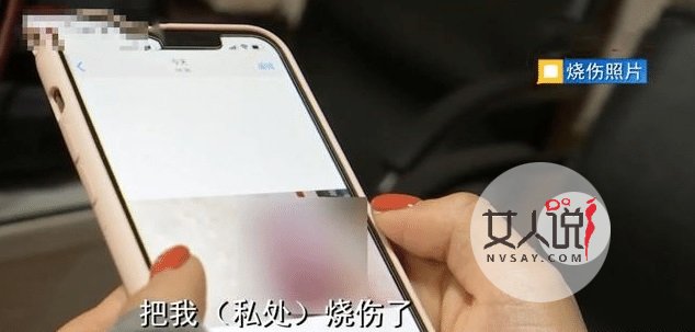 22岁女孩脱毛 不料私处被烧伤 爱美固然好安全更重要啊